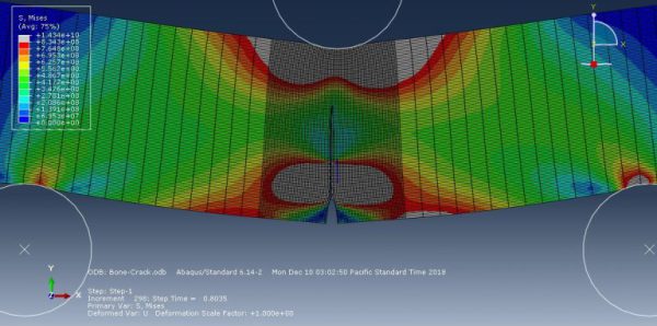 Bio-Mechanical Abaqus Simulation Full Package - CAE Assistant