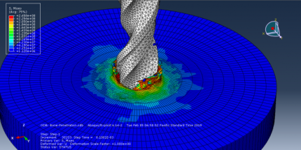 Bio-Mechanical Abaqus Simulation Full Package - CAE Assistant